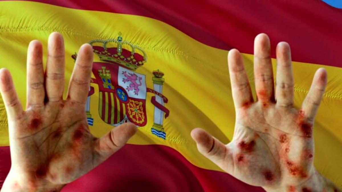 España es el país europeo con más de 8.104 casos de mpox desde 2022