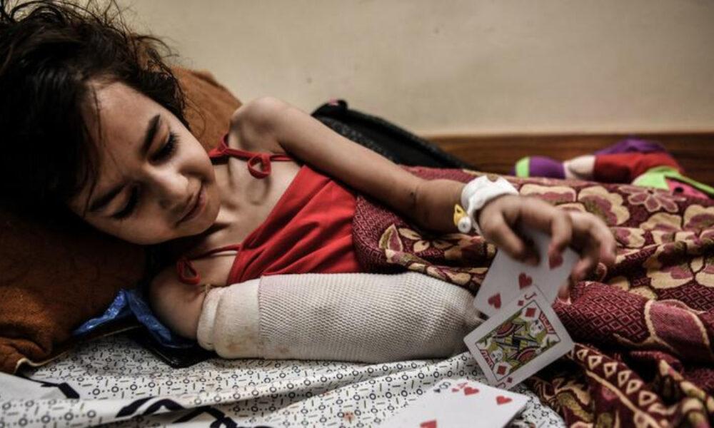 UNICEF: Gaza posee el mayor número de niños discapacitados en el mundo por ataques israelíes