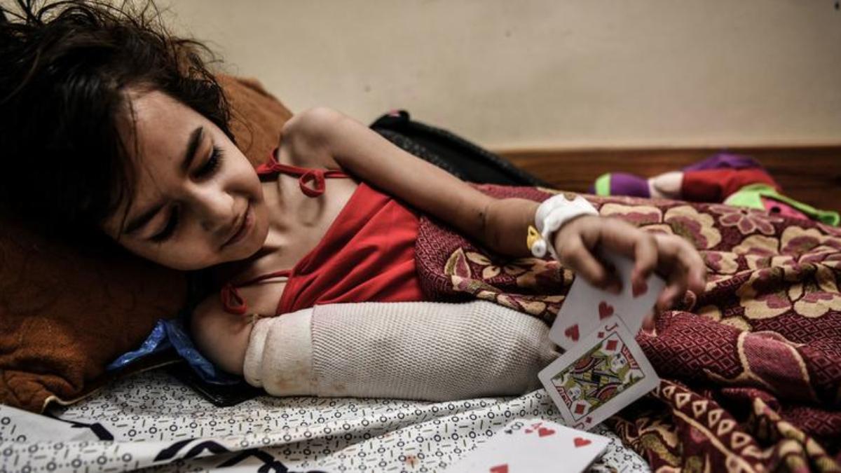 UNICEF: Gaza posee el mayor número de niños discapacitados en el mundo por ataques israelíes