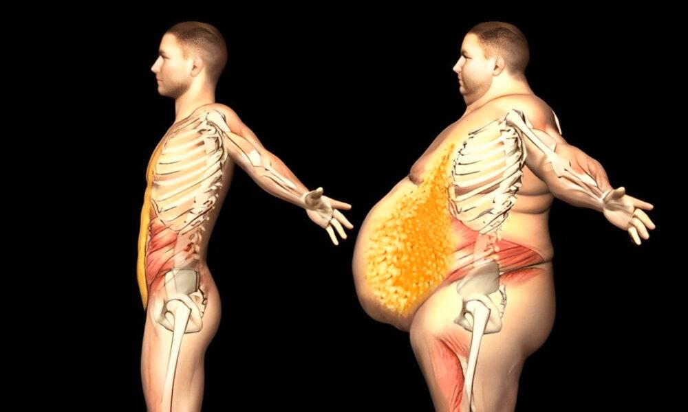 Estudio: grasa abdominal guarda relación con signos de alzhéimer 20 años antes de detectarse