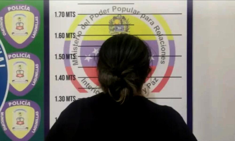 Zulia: Detenida mujer, le quemó la mano a su hija por agarrar el celular